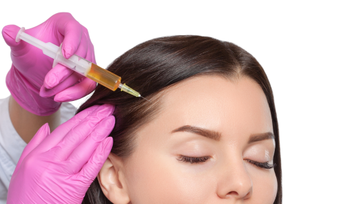 PRP Platelet Rich Plasma: A Therapy for Hair Growth